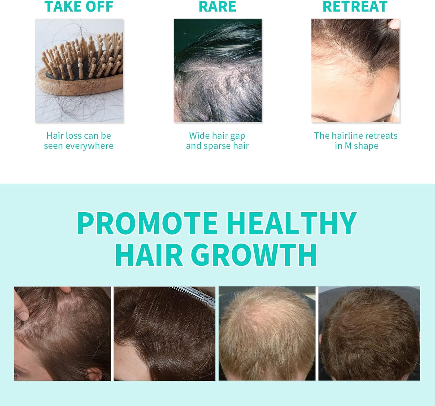 OUHOE Scalp Reboost NMN Hair Growth Roller