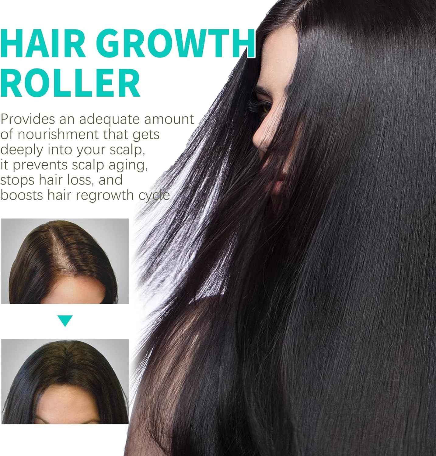 OUHOE Scalp Reboost NMN Hair Growth Roller